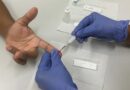 Angra dos Reis intensifica ações do Julho Amarelo com testagem rápida para hepatites virais